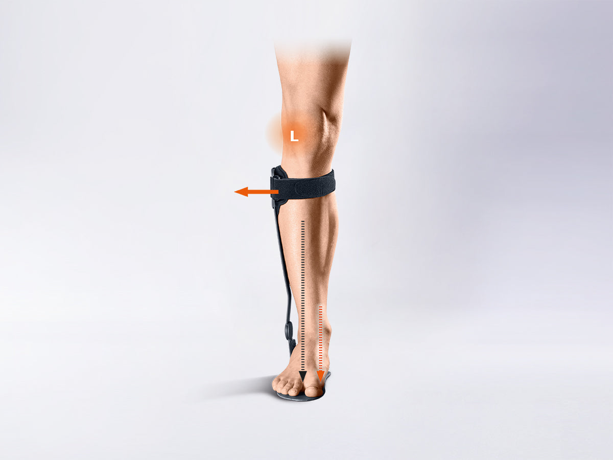 V-FORCE® Férula de alivio de rodilla (AO) para el compartimento medial o lateral en caso de artrosis femoro-tibial) de la rodilla (gonartrosis)