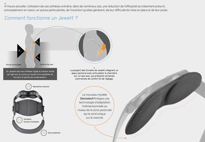 Corsé Jewett no articulado con apoyo esternal tridimensional SternoTech