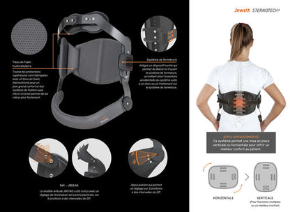 Corsé Jewett articulado con apoyo esternal tridimensional SternoTech