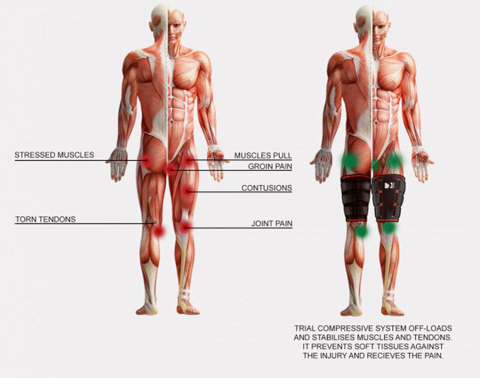 Vendaje de compresión con correas para la rotura muscular